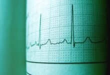 trace call origins accurately